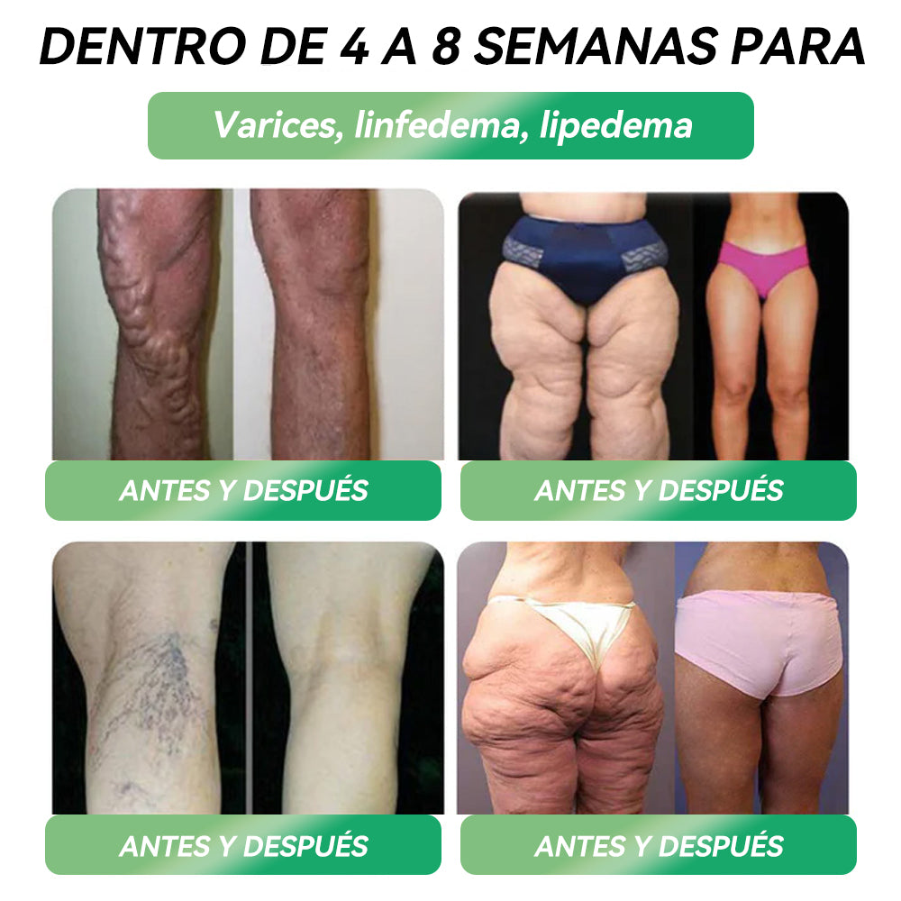 La Elecciรณn de los Expertos Espaรฑoles๐ฉโโ๏ธ|๐ฅ๐๐๐๐๐๐ยฎ ๐๐๐-๐ - ๐๐ฆ๐ฉ๐จ๐ฅ๐ฅ๐๐ฌ ๐๐ซ๐๐ฅ๐๐ฌ ๐๐ ๐รบ๐ฅ๐ญ๐ข๐ฉ๐ฅ๐ ๐๐๐๐ขรณ๐ง (๐๐ฎ๐ฌ๐ญ ๐จ๐ง๐๐ ๐ ๐๐๐ฒ, ๐ฏ๐ข๐ฌ๐ข๐๐ฅ๐ ๐๐ก๐๐ง๐ ๐๐ฌ ๐ข๐ง ๐ ๐๐๐ฒ๐ฌ) ๐
๐จ๐ซ ๐จ๐๐๐ฌ๐ข๐ญ๐ฒ, ๐๐๐ซ๐๐ข๐จ๐ฏ๐๐ฌ๐๐ฎ๐ฅ๐๐ซ ๐ก๐๐๐ฅ๐ญ๐ก, ๐๐ข๐๐๐๐ญ๐๐ฌ, ๐ฌ๐ฅ๐๐๐ฉ ๐๐ฉ๐ง๐๐, ๐๐ฎ๐ญ ๐๐๐๐ฅ๐ญ๐ก, ๐ฃ๐จ๐ข๐ง๐ญ ๐ข๐ฌ๐ฌ๐ฎ๐๐ฌ, ๐๐ง๐ ๐ฆ๐จ๐ซ๐โ
